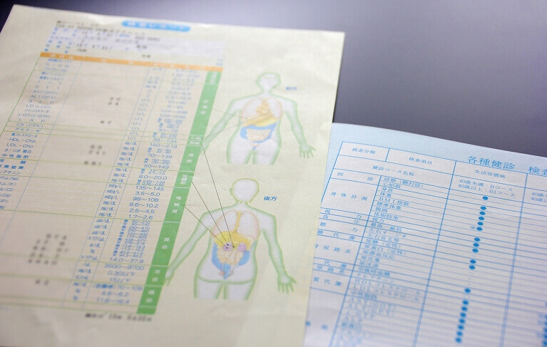 健康診断の眼科項目で再検査になったら