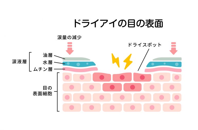 涙の構造