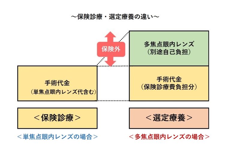 選定療養について